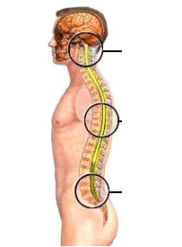 the stages of development degenerative disc disease