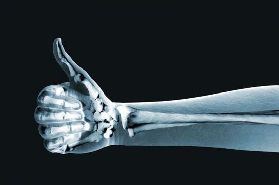 An X-ray can help diagnose pain in the finger joints