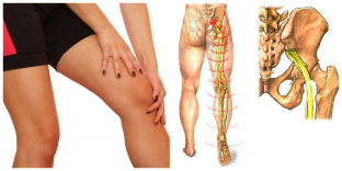 back and leg pain treatment