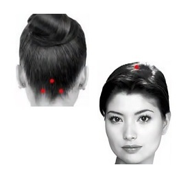 The point is the headache of head - crown of head and nape