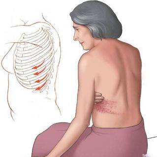 pain, ribs, back causes