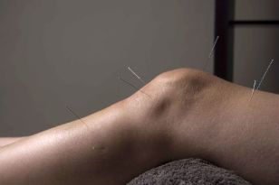 Acupuncture promotes the recovery of joint tissue